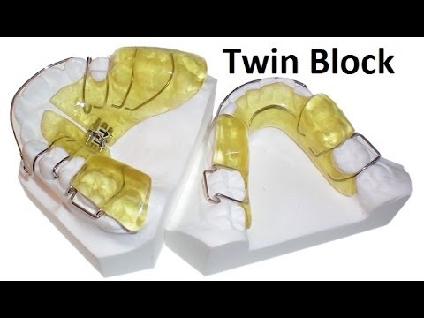 Twin Blocks by Redhead Orthodontics